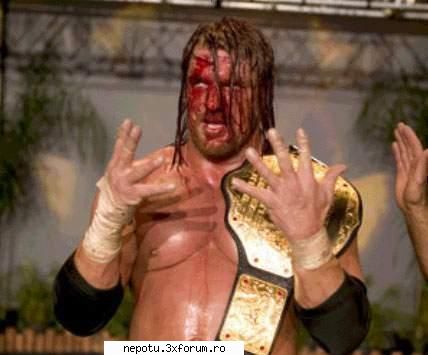 un campion insangerat :( triple h poze